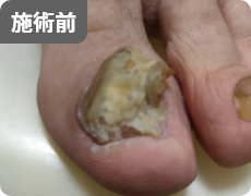 施術前