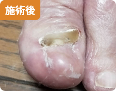 施術後