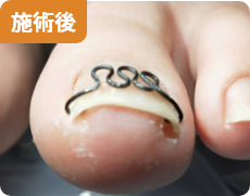 施術後